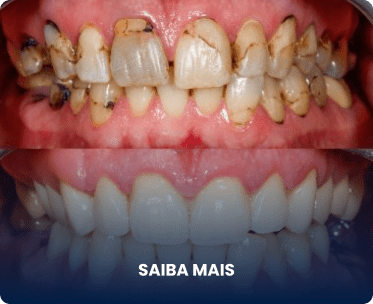 Exemplo 1, Imagem de procedimento bem feito