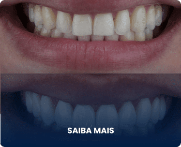 Exemplo 3, Imagem de procedimento bem feito