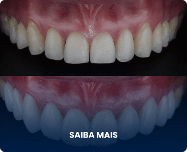 Exemplo 2, Imagem de procedimento bem feito